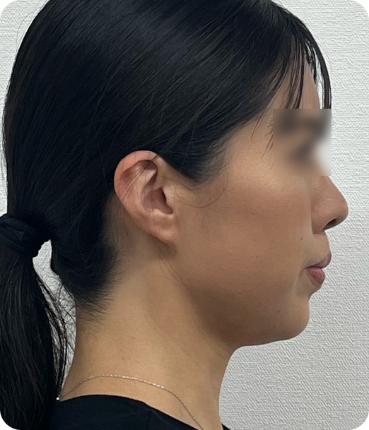 レモンボトル ギャラリー