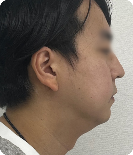 レモンボトル ギャラリー