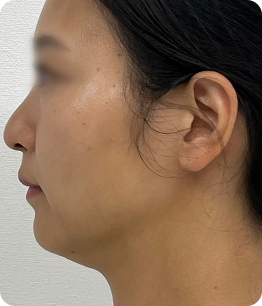 レモンボトル ギャラリー