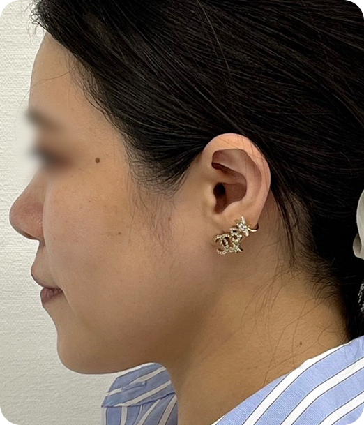 レモンボトル ギャラリー