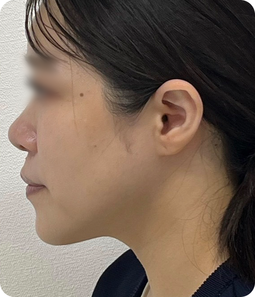 レモンボトル ギャラリー