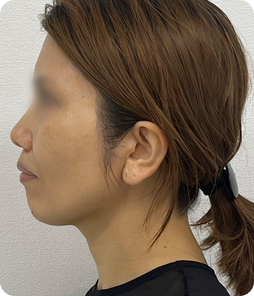 レモンボトル ギャラリー