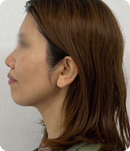 レモンボトル ギャラリー