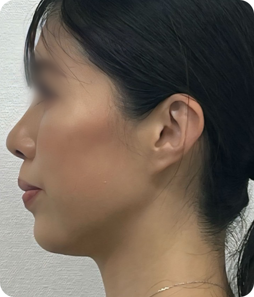 レモンボトル ギャラリー