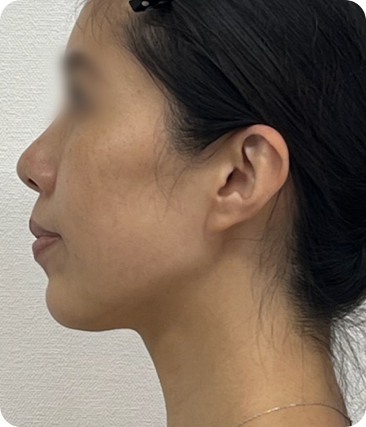 レモンボトル ギャラリー