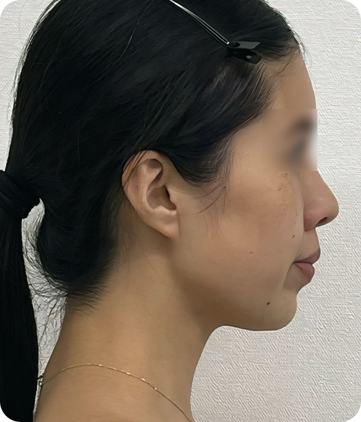 レモンボトル ギャラリー