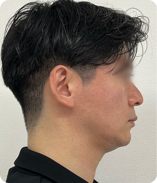 レモンボトル ギャラリー