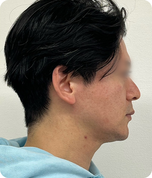 レモンボトル ギャラリー