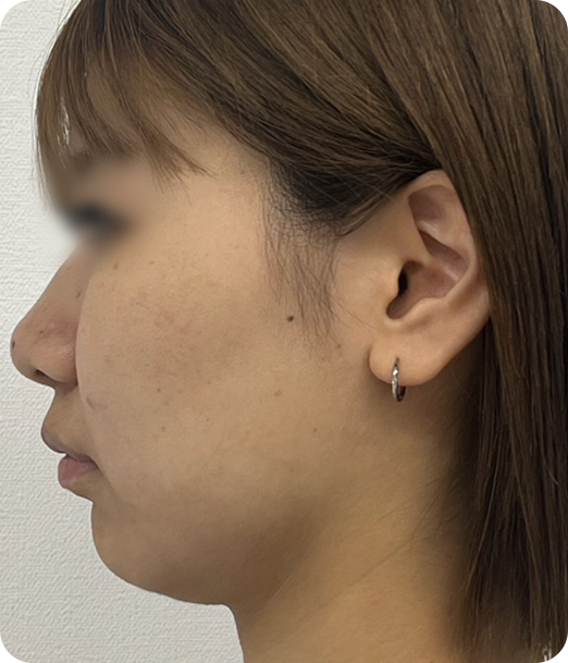 レモンボトル ギャラリー