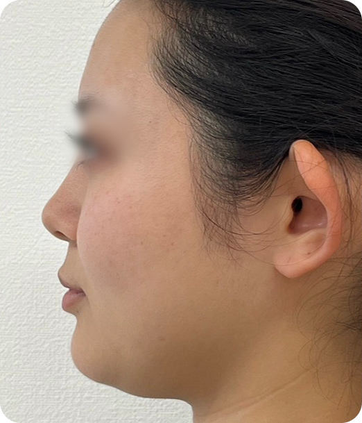 レモンボトル ギャラリー