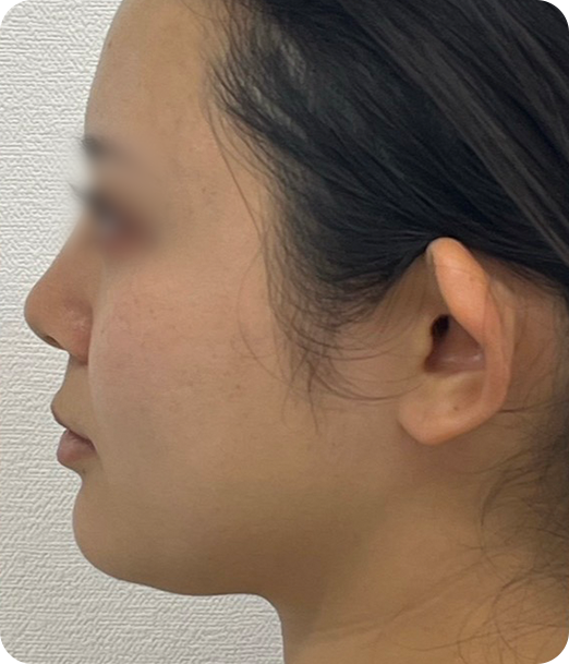 レモンボトル ギャラリー