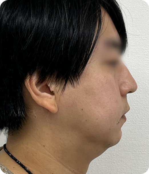 レモンボトル ギャラリー