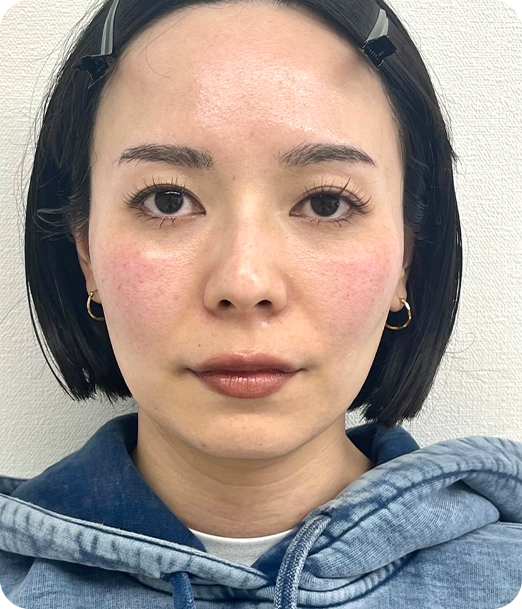 エクソソーム ギャラリー