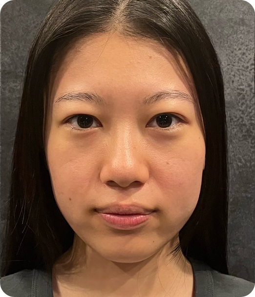 エクソソーム ギャラリー