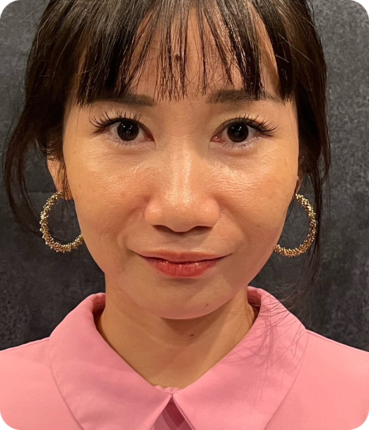 エクソソーム ギャラリー