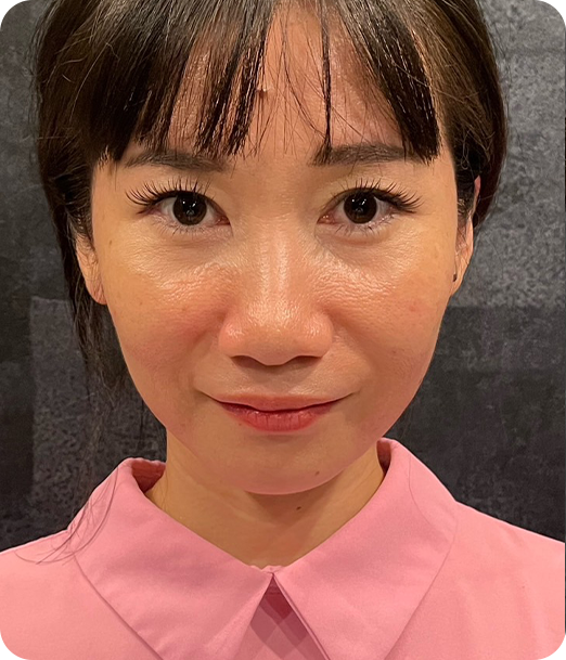 エクソソーム ギャラリー