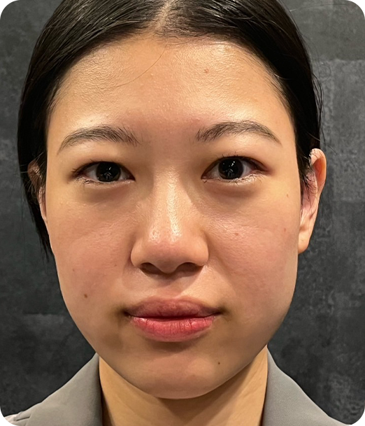 エクソソーム ギャラリー