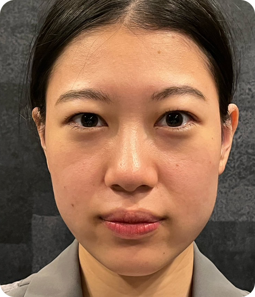 エクソソーム ギャラリー