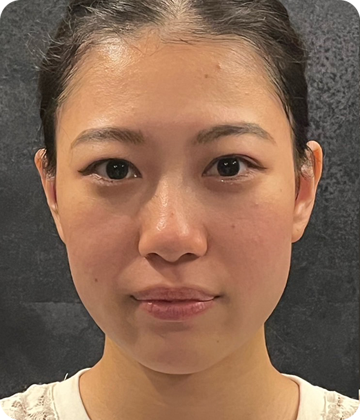 エクソソーム ギャラリー