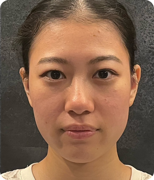 エクソソーム ギャラリー