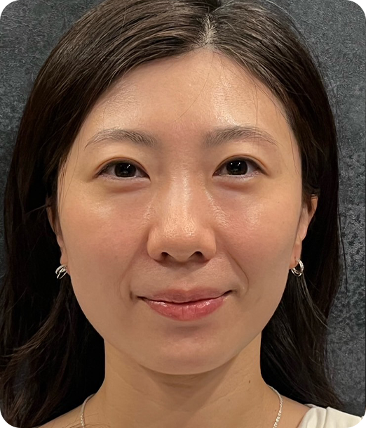 エクソソーム ギャラリー