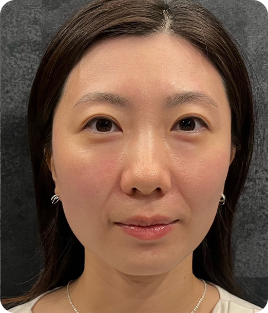 エクソソーム ギャラリー