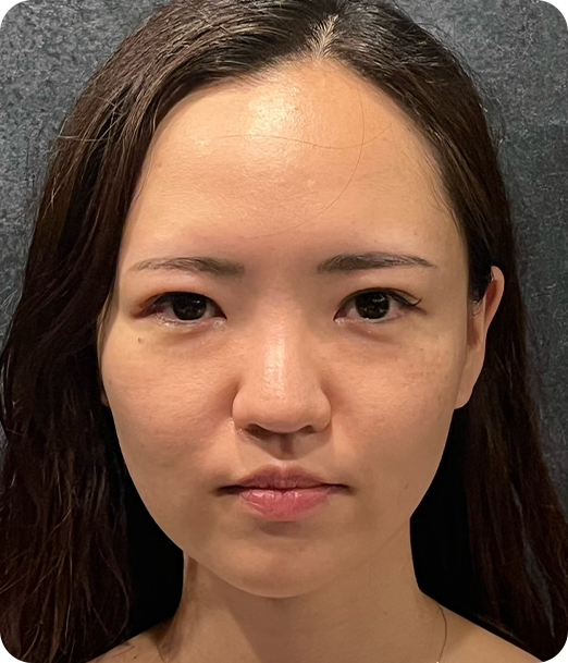 エクソソーム ギャラリー