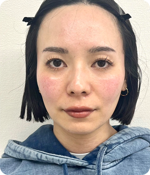 エクソソーム ギャラリー