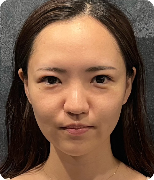 エクソソーム ギャラリー