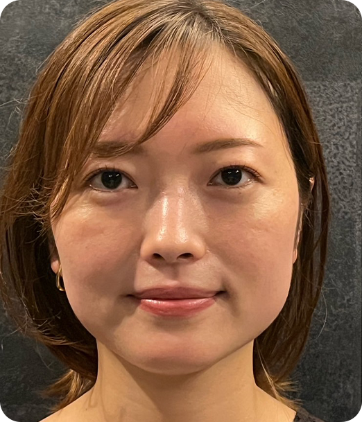 エクソソーム ギャラリー