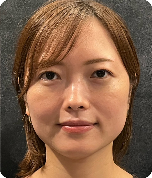 エクソソーム ギャラリー