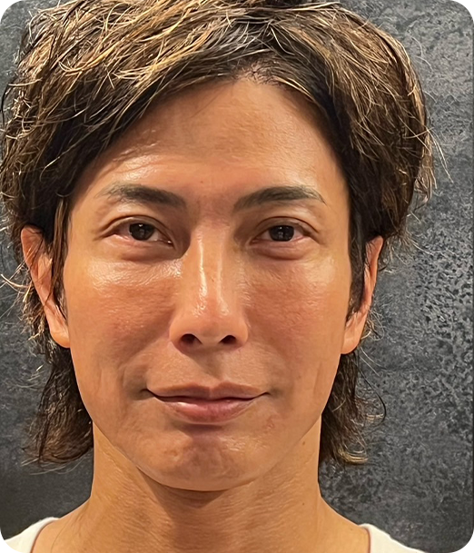 エクソソーム ギャラリー