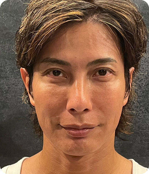 エクソソーム ギャラリー