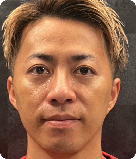 エクソソーム ギャラリー