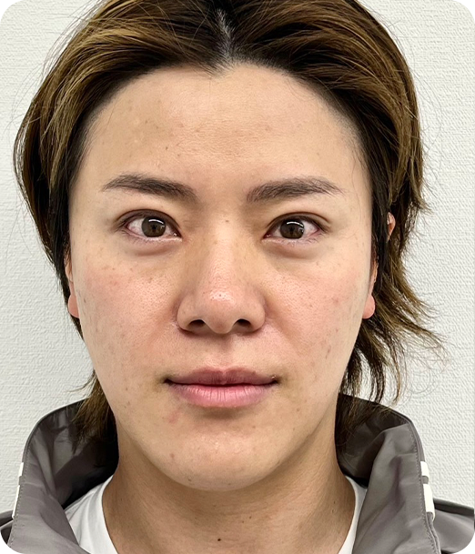 エクソソーム ギャラリー