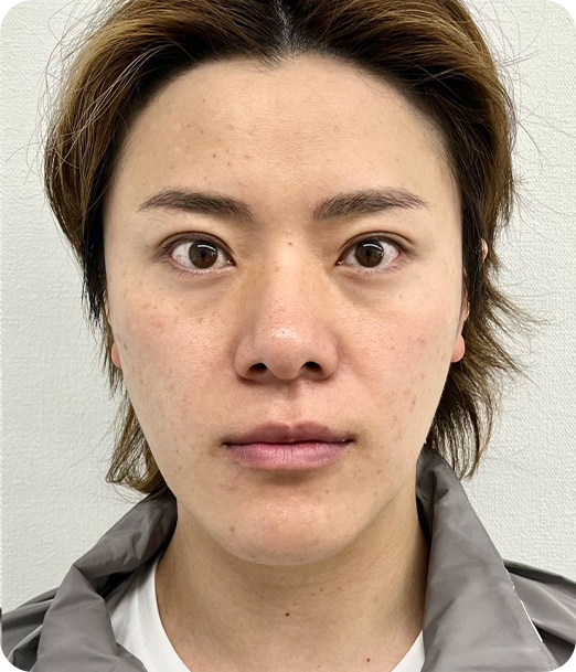 エクソソーム ギャラリー