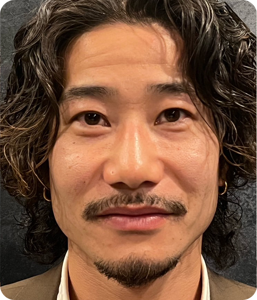 エクソソーム ギャラリー