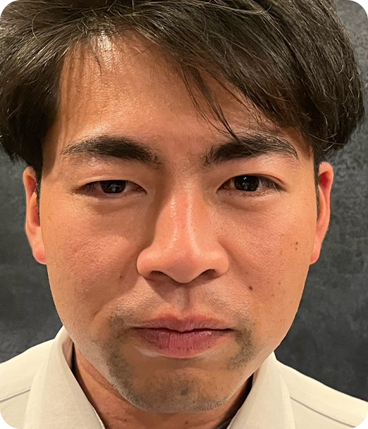 エクソソーム ギャラリー