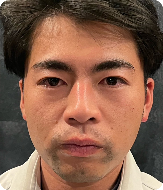 エクソソーム ギャラリー