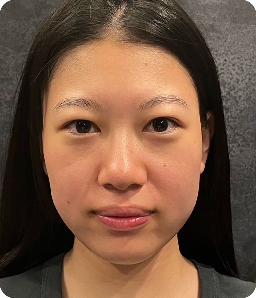 エクソソーム ギャラリー