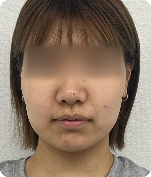 レモンボトル ギャラリー