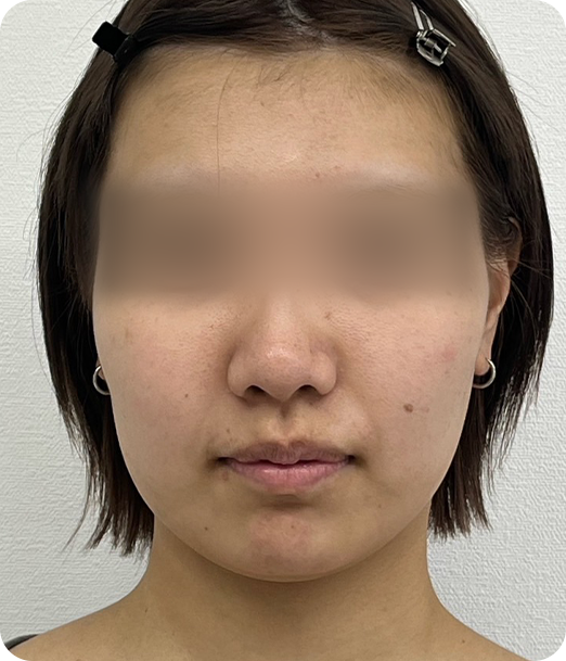 レモンボトル ギャラリー