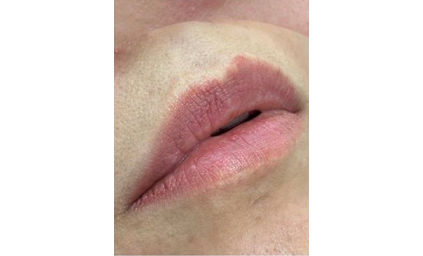 ローマピンク ギャラリー