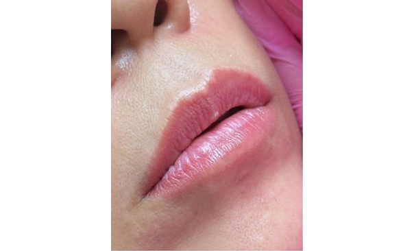 ローマピンク ギャラリー