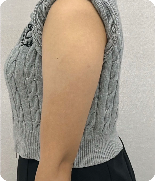 レモンボトル ギャラリー