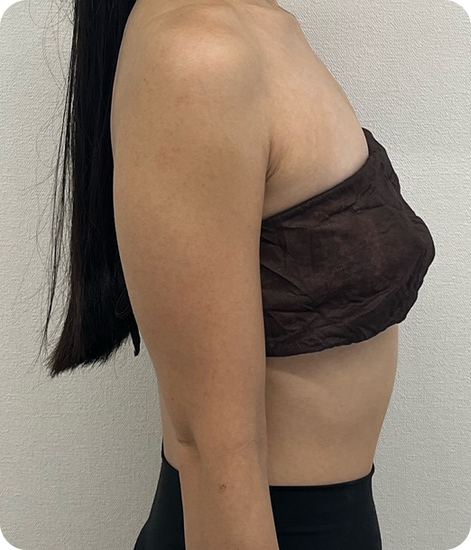 レモンボトル ギャラリー