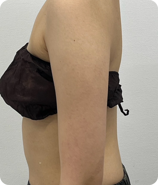 レモンボトル ギャラリー