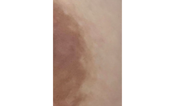 ローマピンク ギャラリー