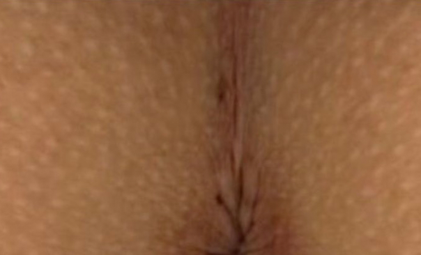 ローマピンク ギャラリー