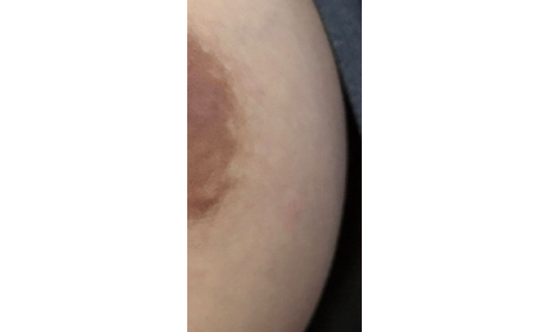 ローマピンク ギャラリー